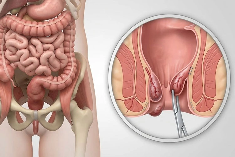 Dr. Diego García Caballero Especialista en Cirugía Laparoscópica y Cirugía Gastrointestinal