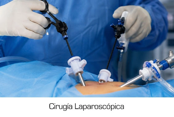 Dr. Diego García Caballero Especialista en Cirugía Laparoscópica y Cirugía Gastrointestinal